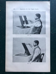 Figs. 116 and 117. Print from “The Treatment of Tabetic Ataxia by Means of Systematic Exercise” by Dr. H. S. Frenkel
